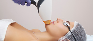 IPL Photo Facial Treatment Specialist Near Me in Midland TX