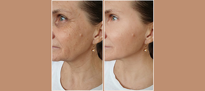 Laser Skin Resurfacing Treatment Specialist Near Me in Midland TX