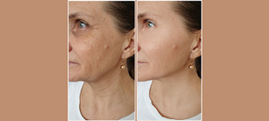 Laser Skin Resurfacing Treatment Specialist Near Me in Midland TX Laser Skin Resurfacing Treatment Specialist Near Me in Midland TX