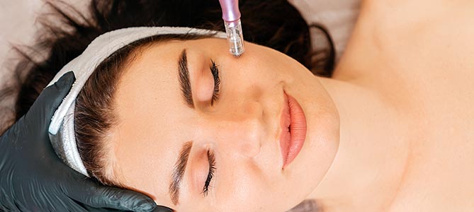 Microneedling Treatment Specialist Near Me in Midland TX