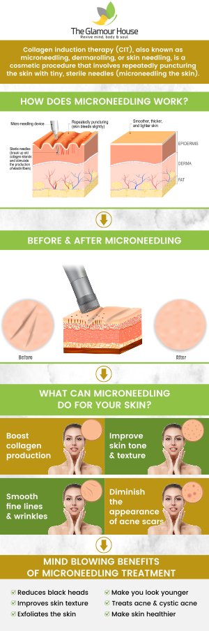 After microneedling, our professional team at The Glamour House provides personalized aftercare instructions to promote healing and enhance results. Avoid sun exposure, strenuous activity, and makeup for at least 24 hours. Keep your skin clean, hydrated, and use only the products we recommend. For more information, contact us or schedule an appointment online. We are conveniently located at 2002 N Midland Dr Suite A, Midland, TX 79707.